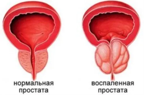 Prostogen : skład tylko naturalne składniki.